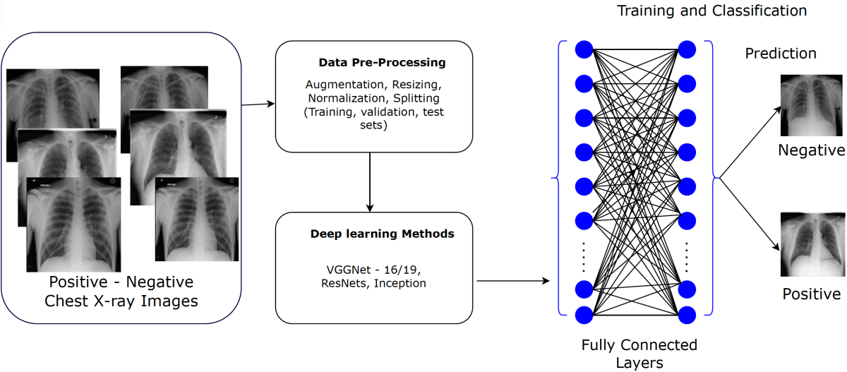 TB Detection in Chest X-Rays